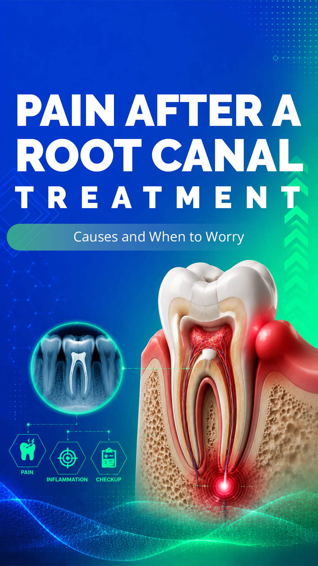 Pain after a Root Canal Treatment: Causes and When to Worry