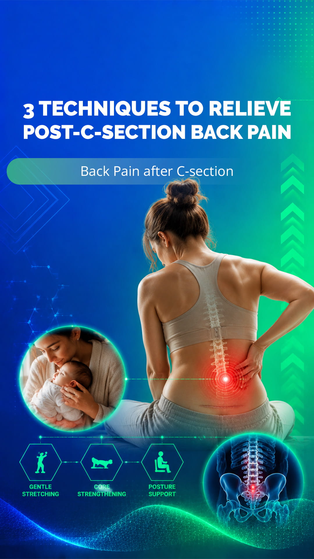 3 Techniques to Relieve Post-C-Section Back Pain | Back Pain after C-section