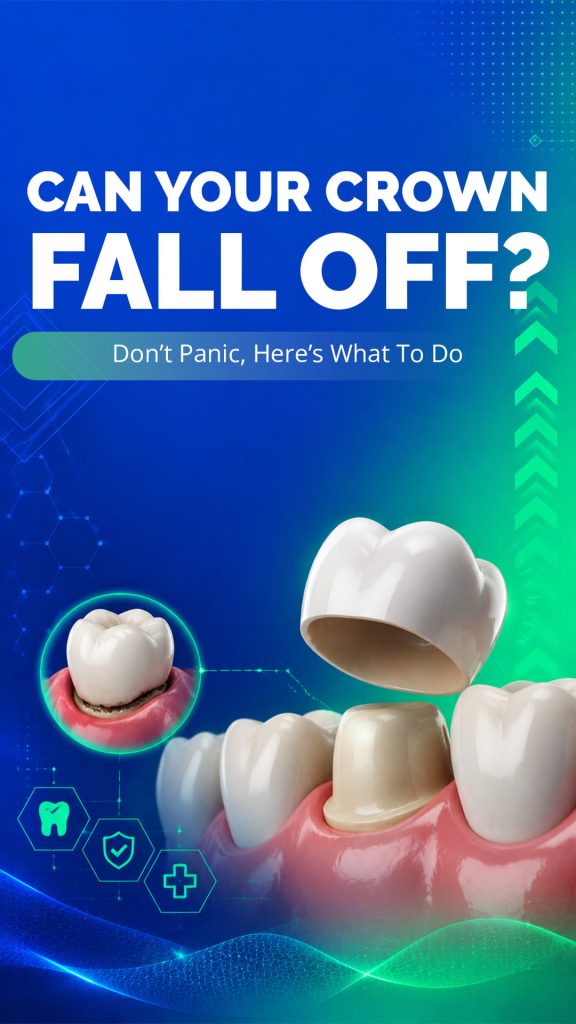 Can Your Crown FALL OFF? | Don’t Panic, Here’s What To Do
