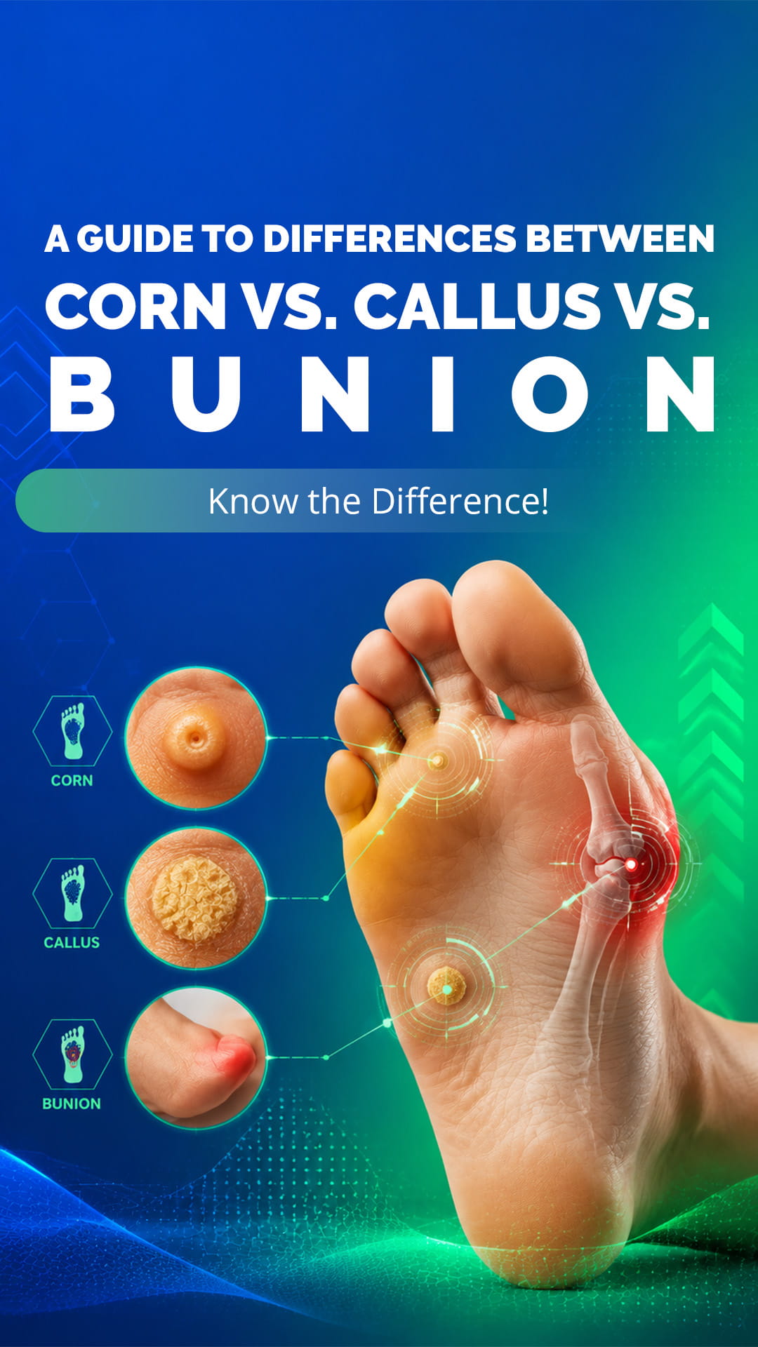 A Guide to Differences Between Corn vs. Callus vs. Bunion. Know the Difference!