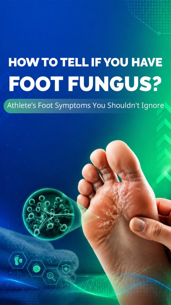 How to Tell if You Have Foot Fungus? Athlete’s Foot Symptoms You Shouldn't Ignore