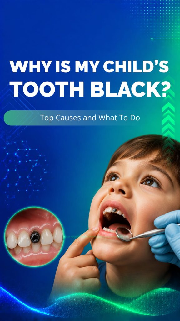Kirkland-Why Is My Child’s Tooth Black