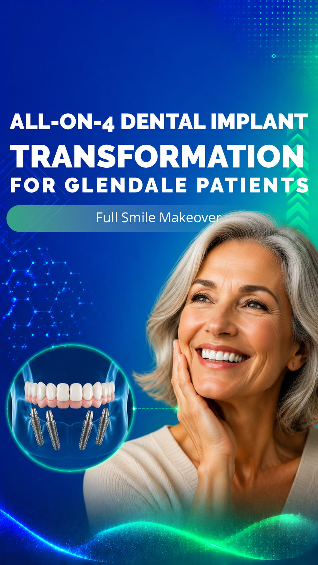 All-On-4 Dental Implants Transformation for Glendale Patients | Full Smile Makeover